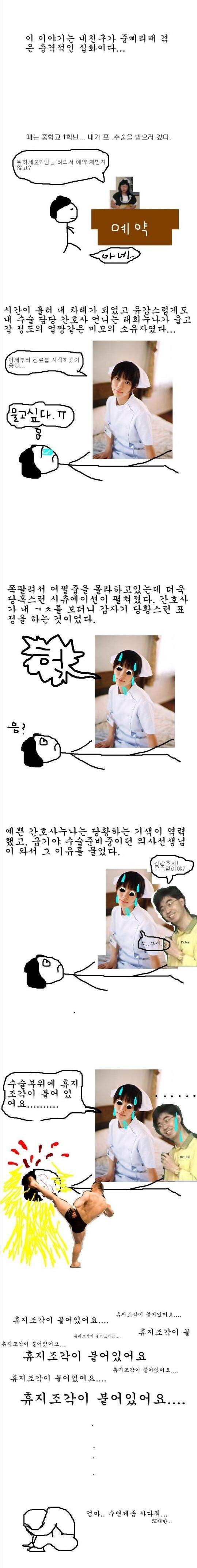 포경수술중 간호사가ㄱㅊ를보고 놀래는이유는...ㄱ-.jpg